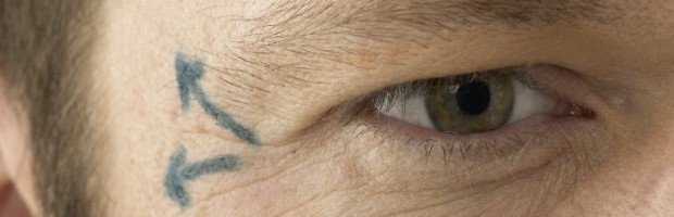 Diferencias entre bótox y ácido hialurónico